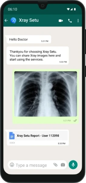 XraySetu product image